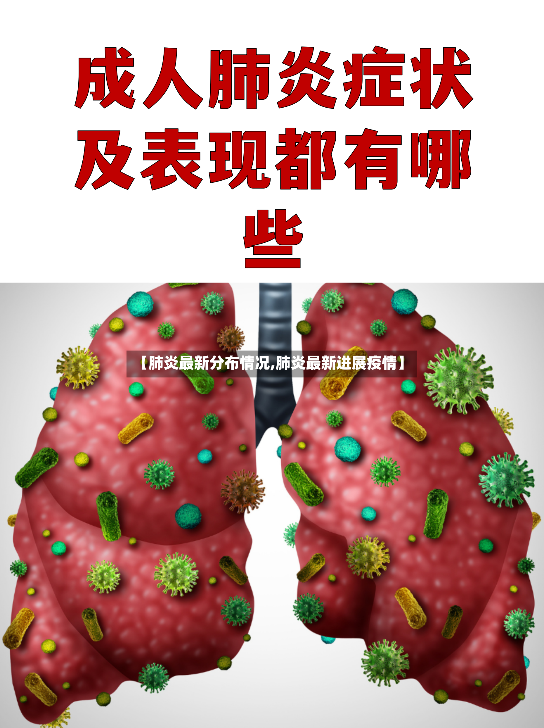 【肺炎最新分布情况,肺炎最新进展疫情】-第2张图片