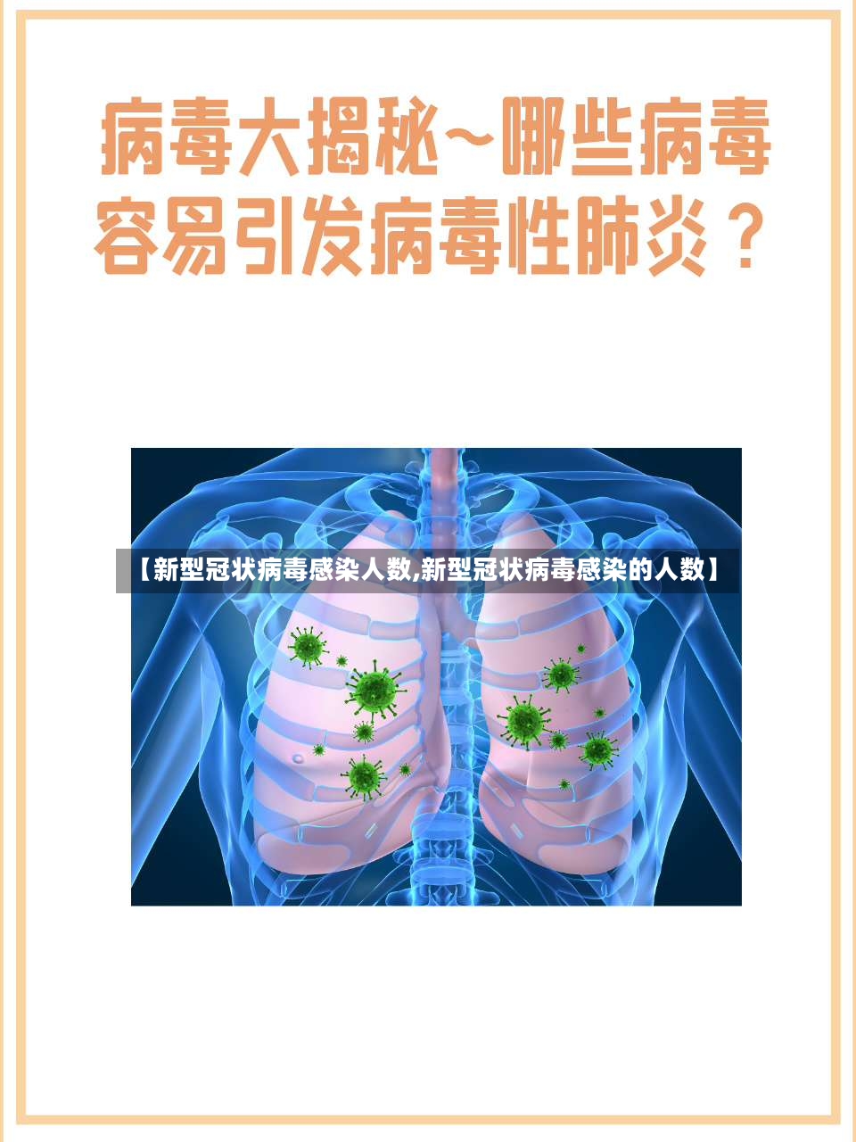 【新型冠状病毒感染人数,新型冠状病毒感染的人数】-第3张图片