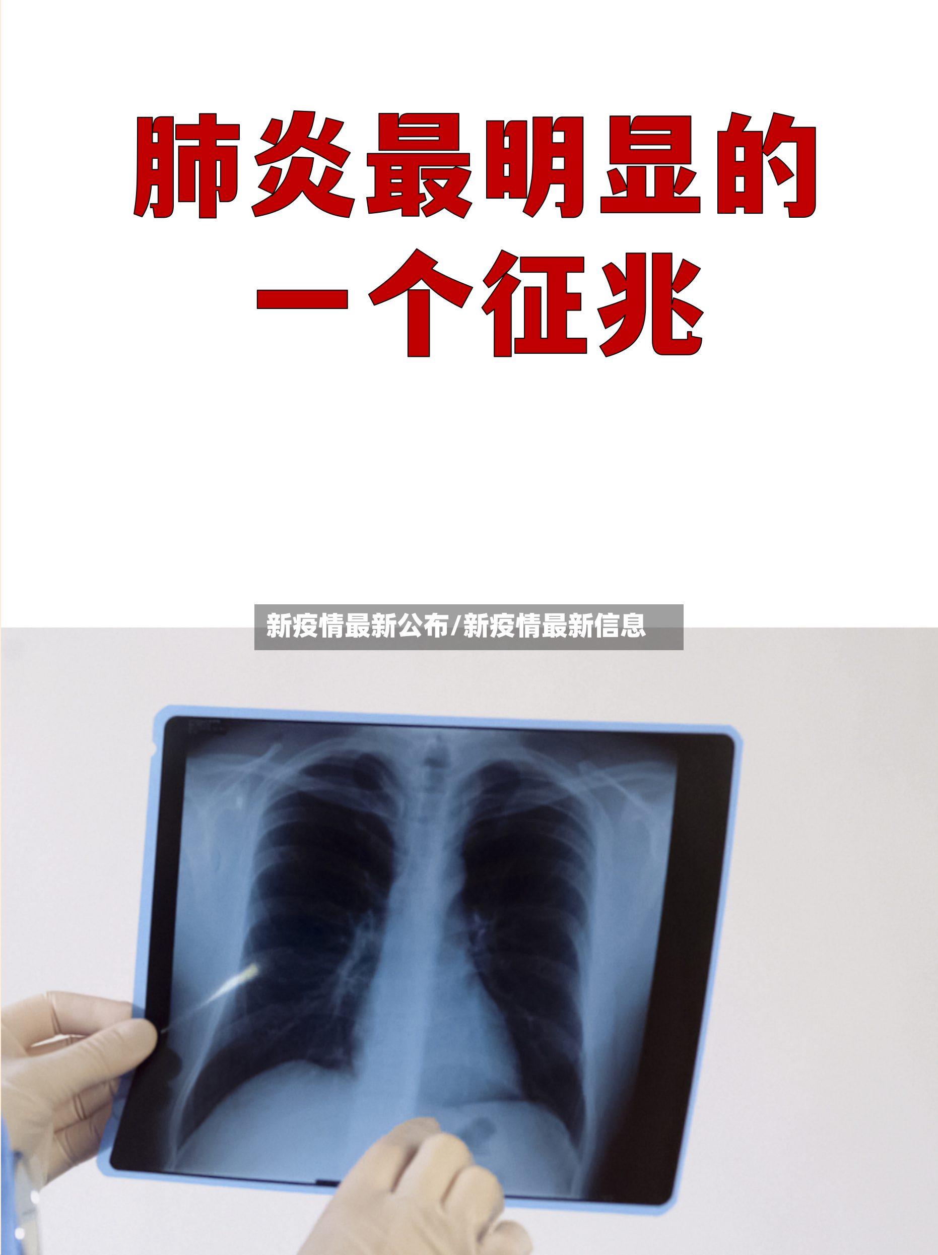 新疫情最新公布/新疫情最新信息