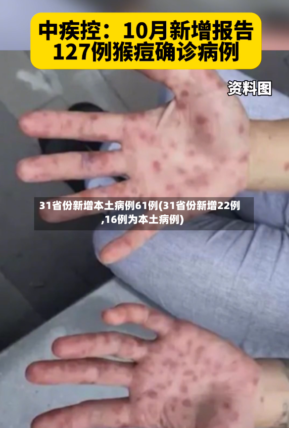 31省份新增本土病例61例(31省份新增22例,16例为本土病例)