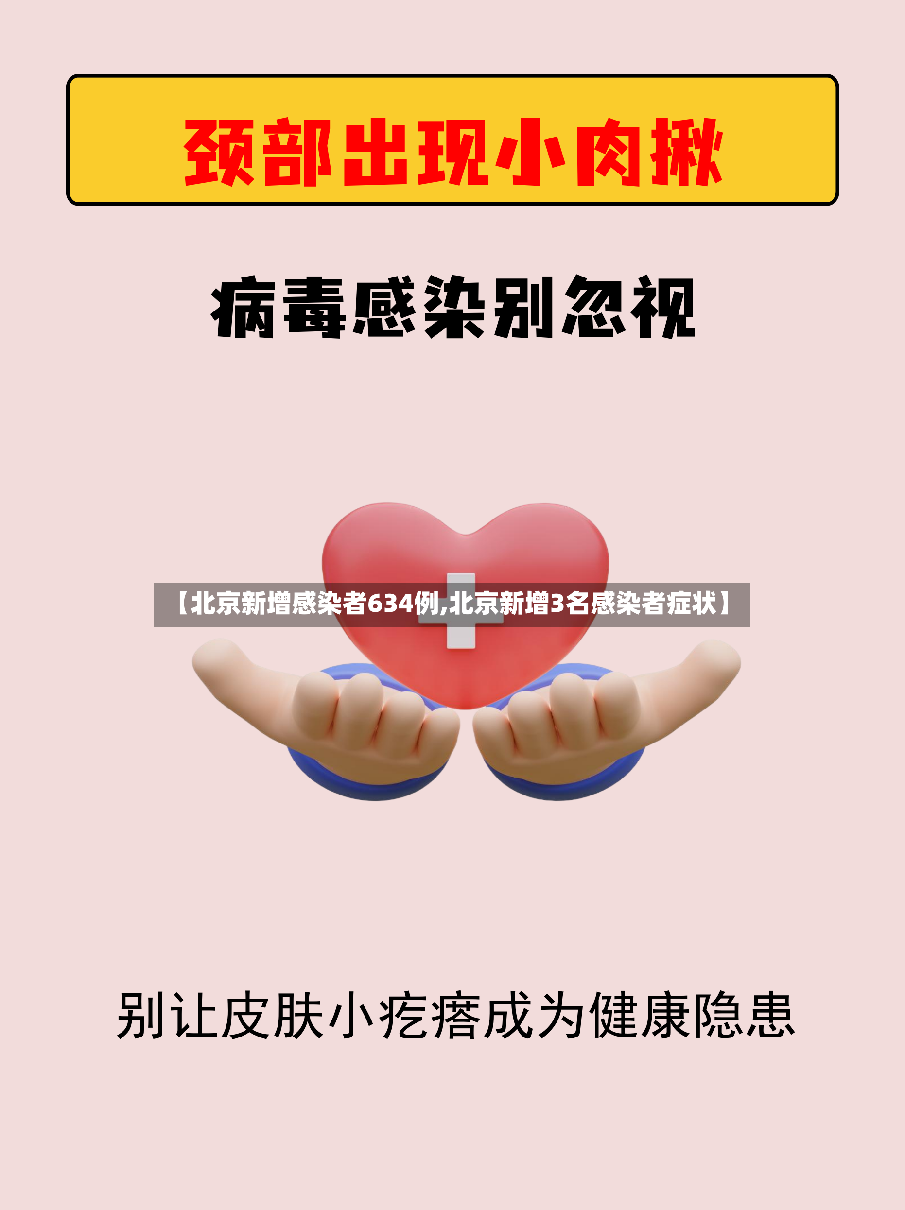 【北京新增感染者634例,北京新增3名感染者症状】-第3张图片