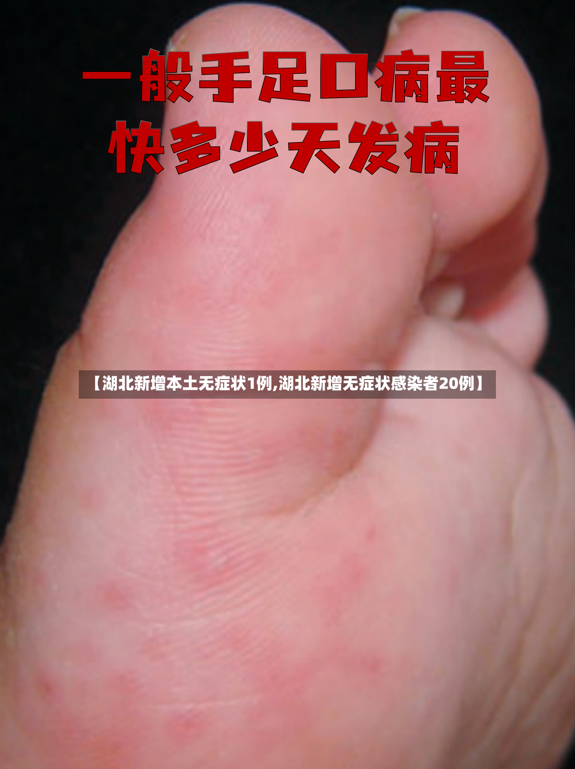 【湖北新增本土无症状1例,湖北新增无症状感染者20例】-第2张图片