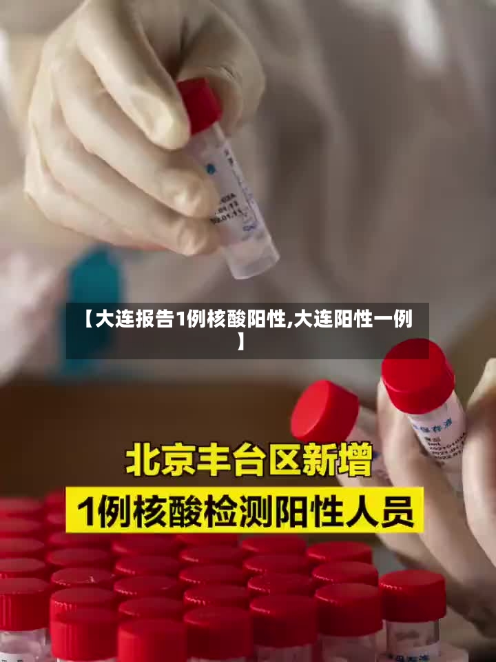 【大连报告1例核酸阳性,大连阳性一例】-第3张图片