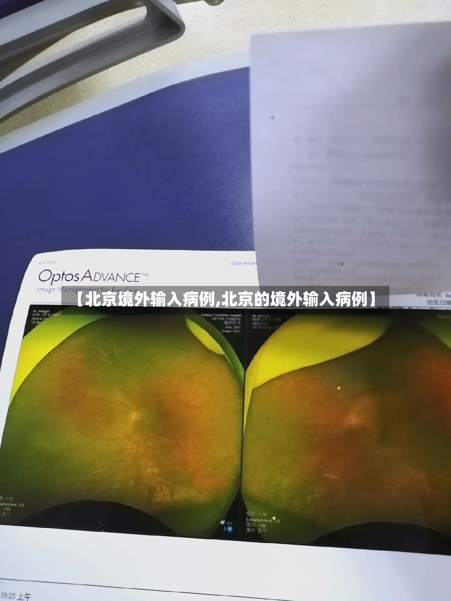 【北京境外输入病例,北京的境外输入病例】-第3张图片
