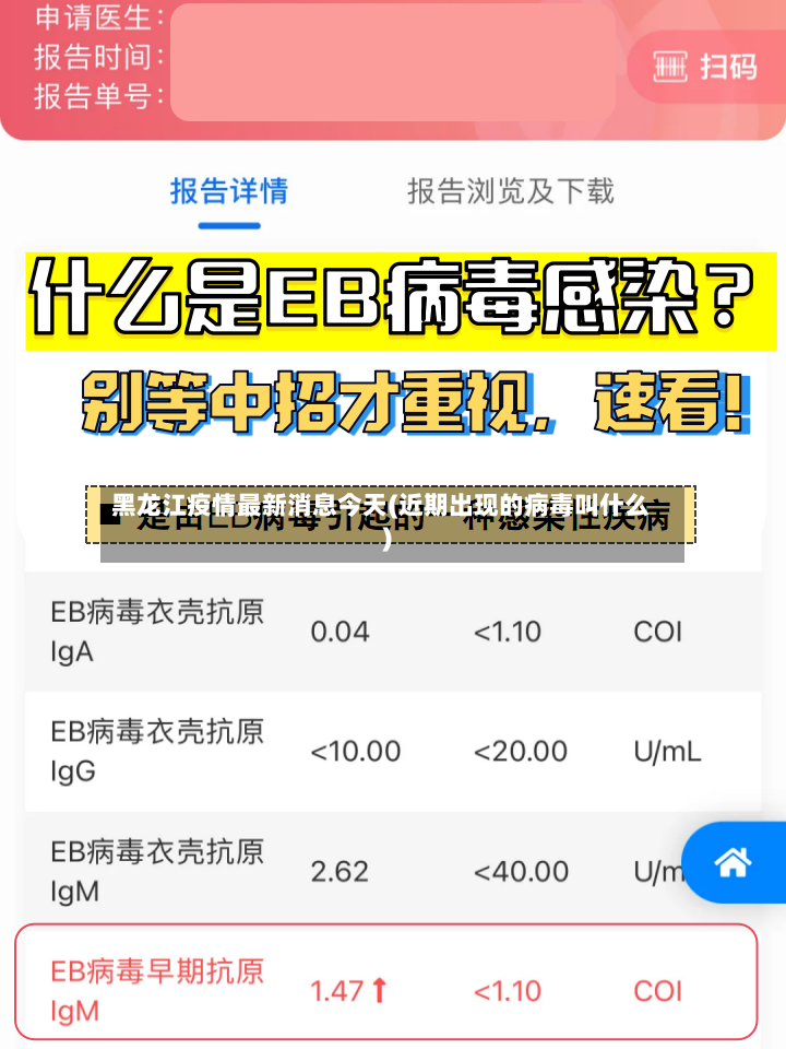黑龙江疫情最新消息今天(近期出现的病毒叫什么)