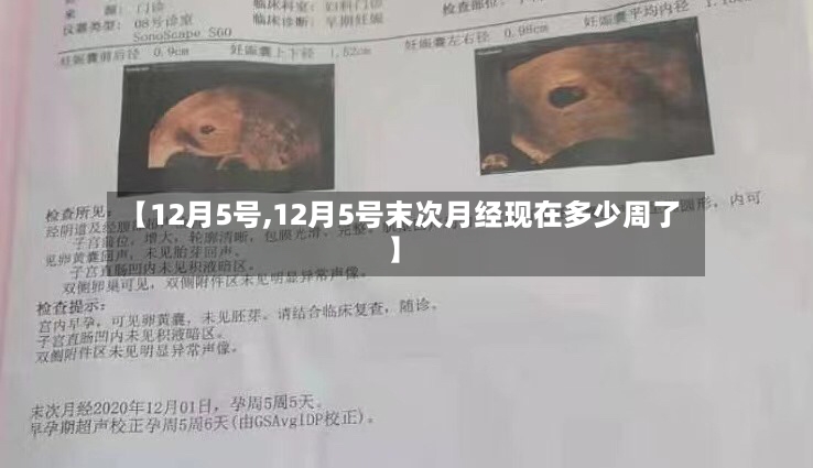 【12月5号,12月5号末次月经现在多少周了】-第3张图片