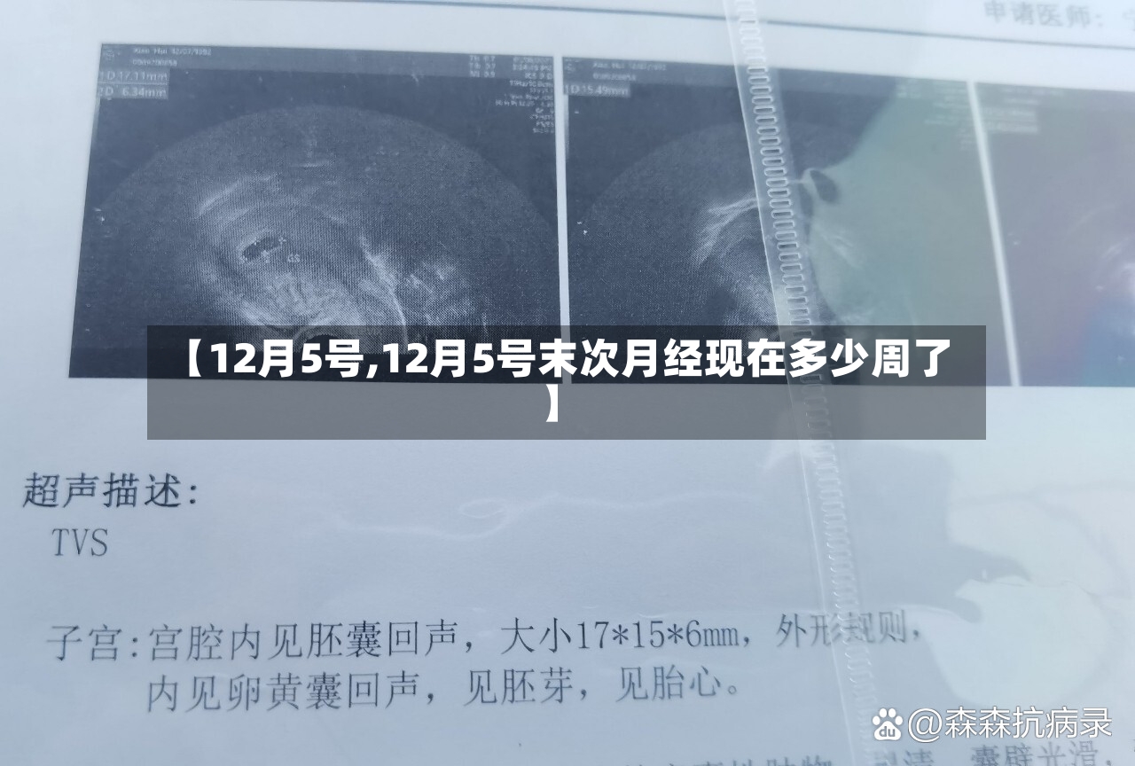【12月5号,12月5号末次月经现在多少周了】-第2张图片
