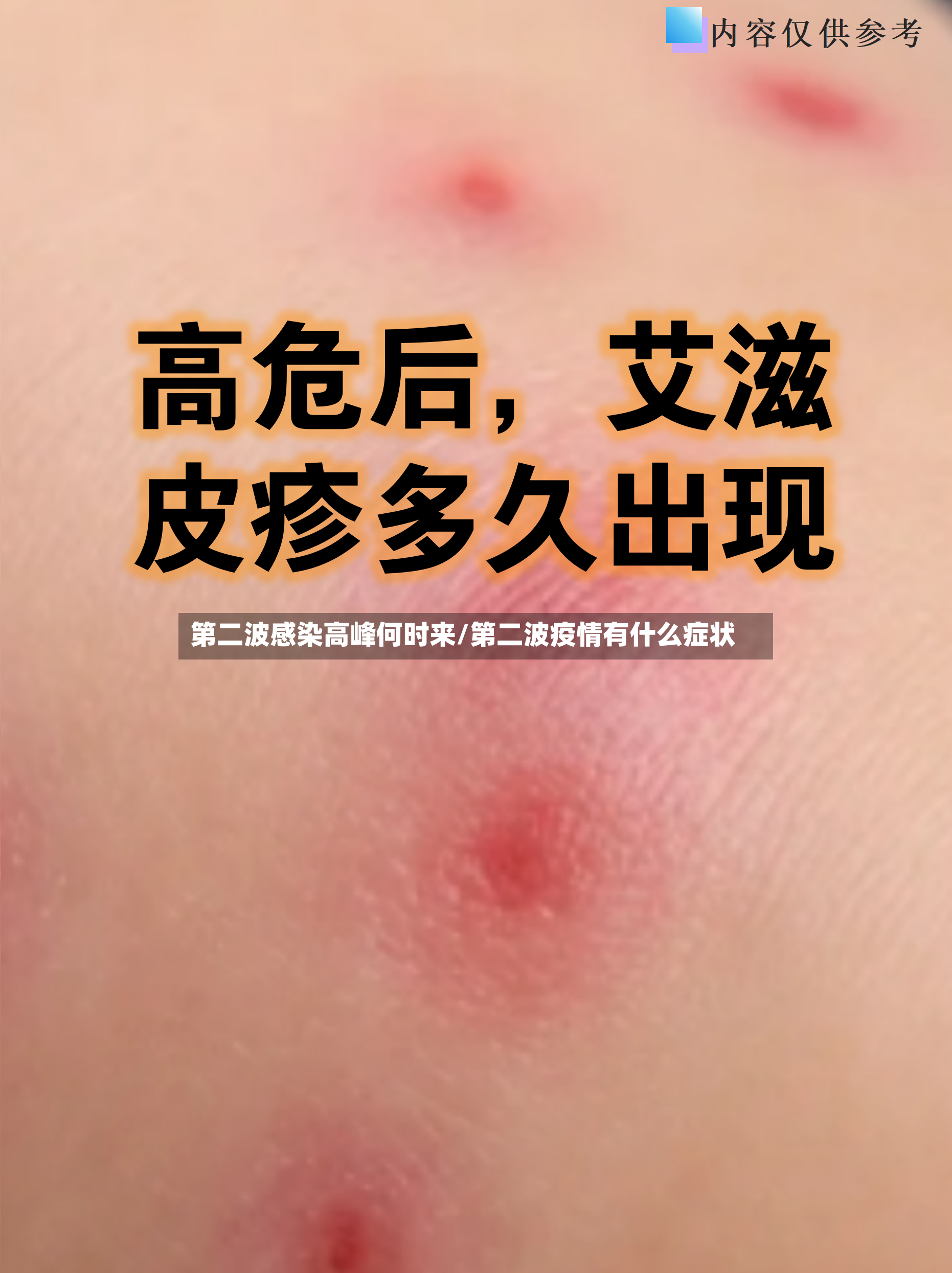 第二波感染高峰何时来/第二波疫情有什么症状