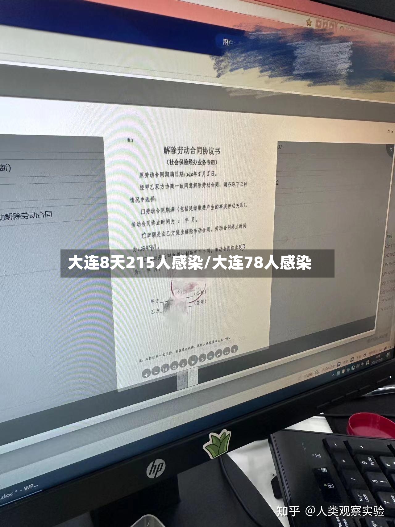 大连8天215人感染/大连78人感染-第2张图片