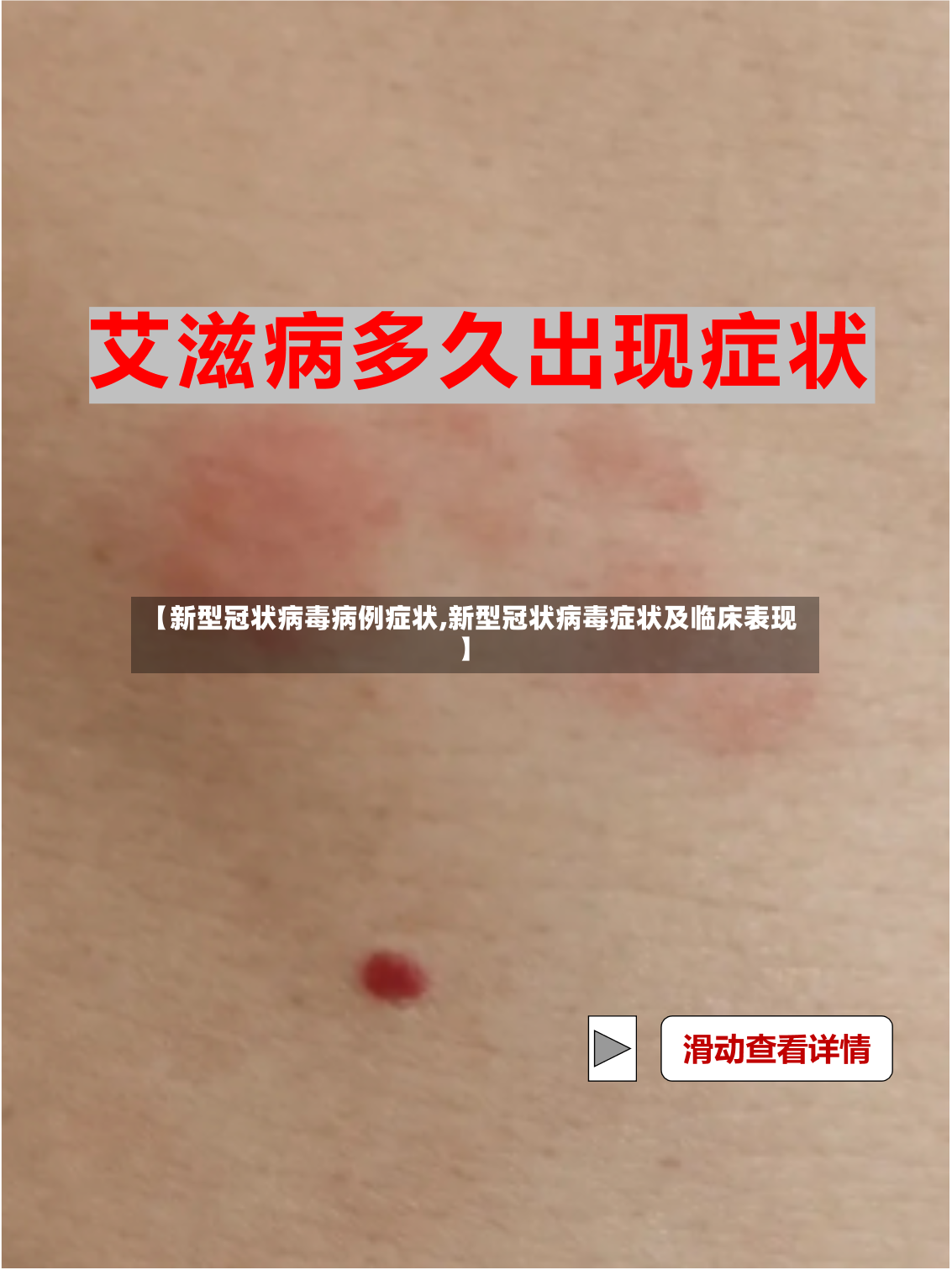 【新型冠状病毒病例症状,新型冠状病毒症状及临床表现】